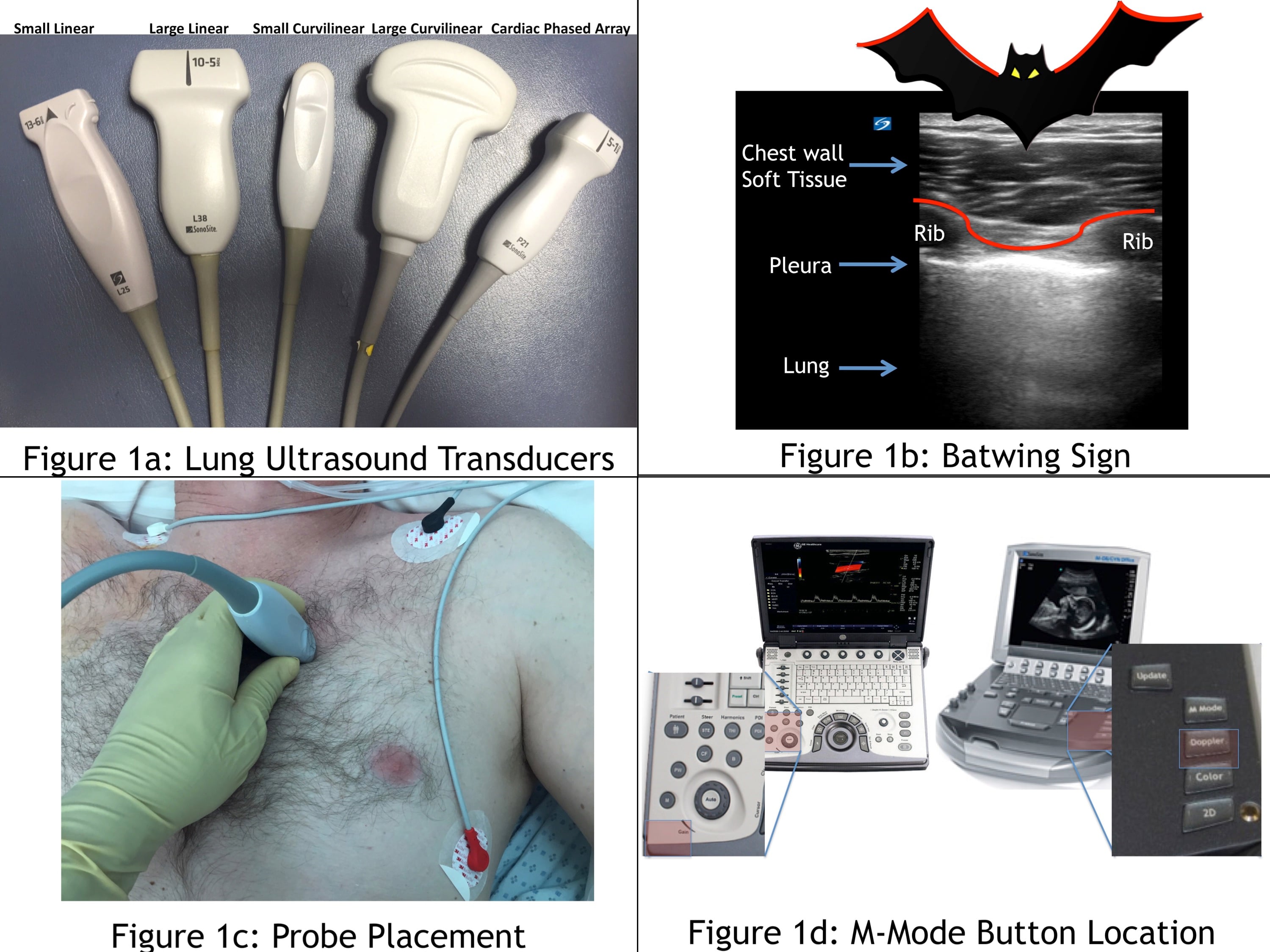 Lung Ultrasound Transducers