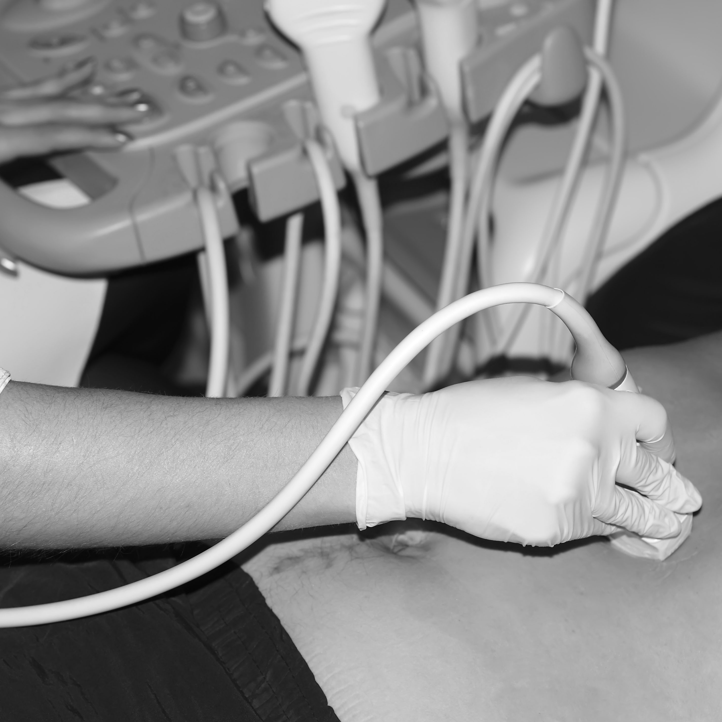 abdominal ultrasound Cropped