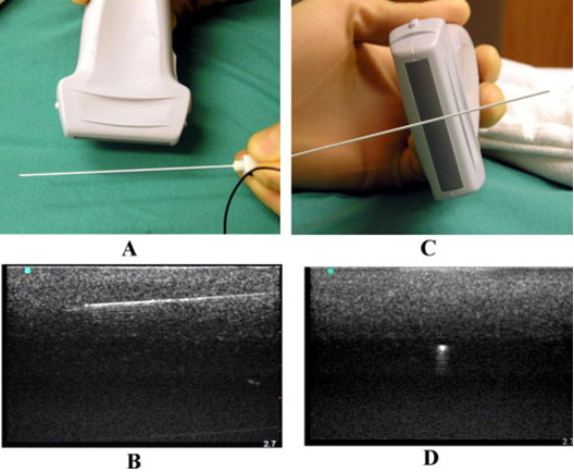 continuous-peripheral-nerve-blocks-from-sites-bd