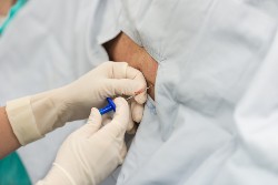Epidural