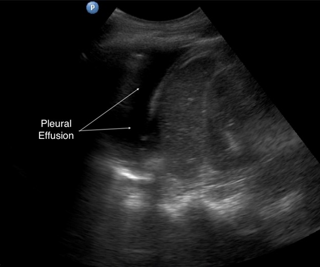 Manson_POCUS_Figure7_News022022