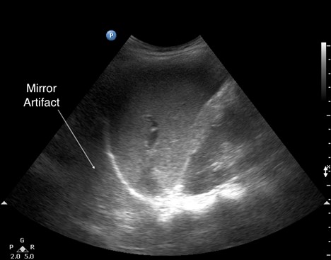 Manson_POCUS_Figure8_News022022