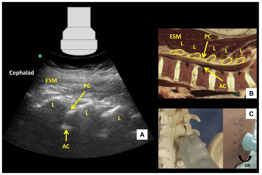 UGLC Figure 2