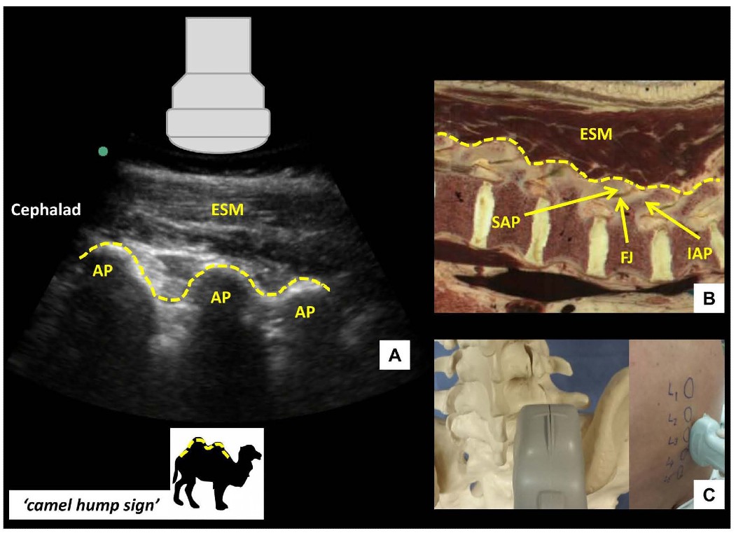 UGLC Figure 3