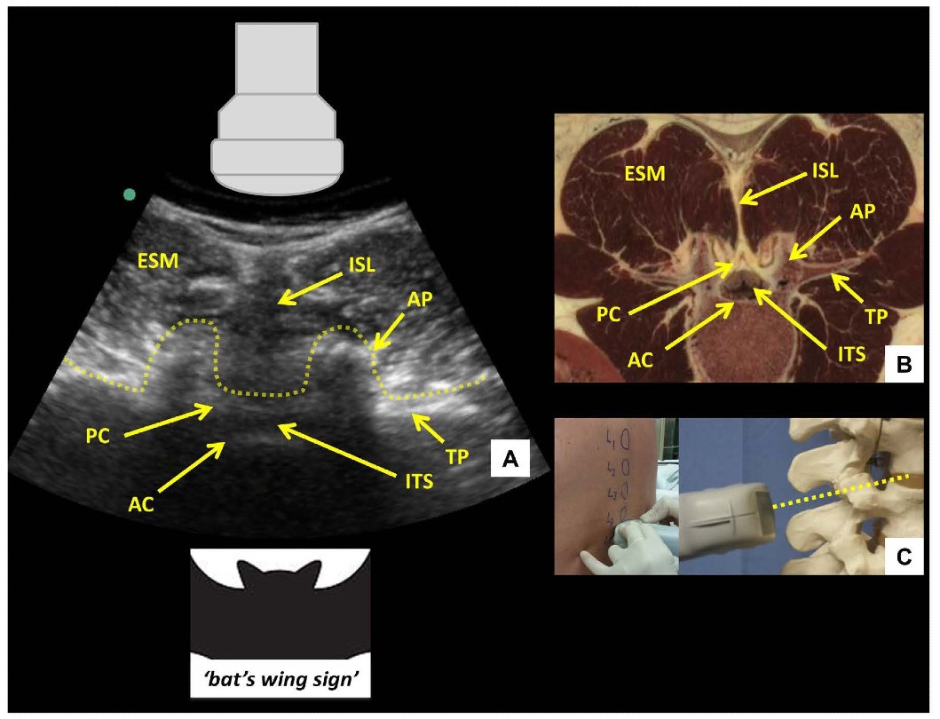 UGLC Figure 5