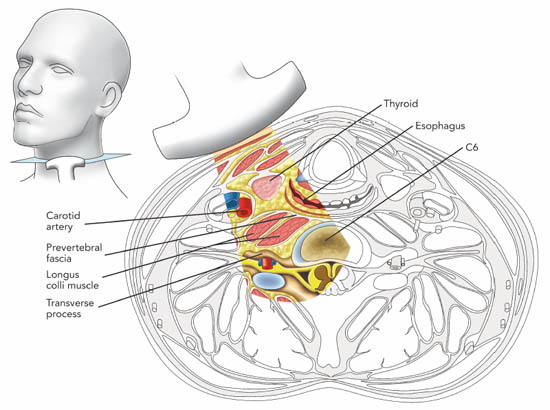 ultrasound-guided-block-for-peripheral-structures-cross-section-of-the-neck