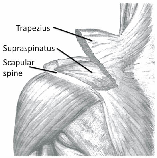 ultrasound-guided-block-for-peripheral-structures-left-shoulder
