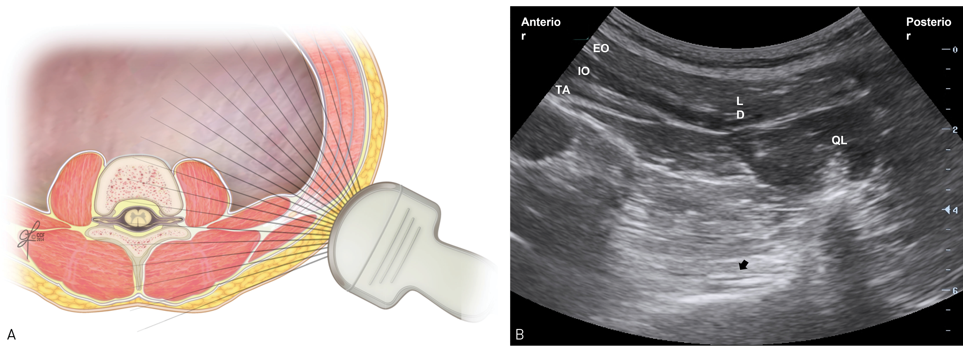 Elsharkawy_Quadratus_Fig5