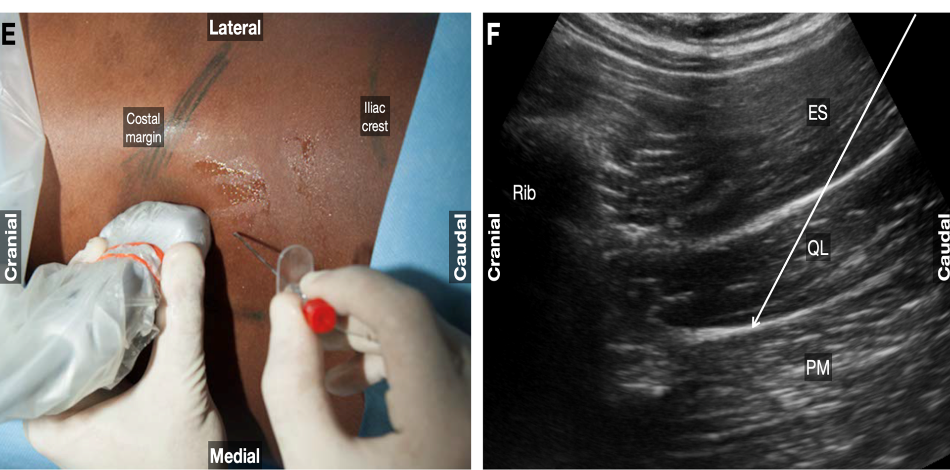 Elsharkawy_Quadratus_Fig8