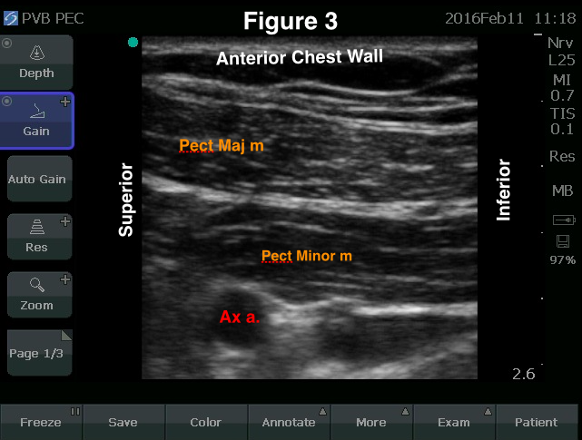 fig3.jpg-2