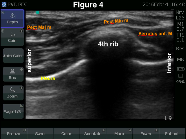 fig4.jpg-2
