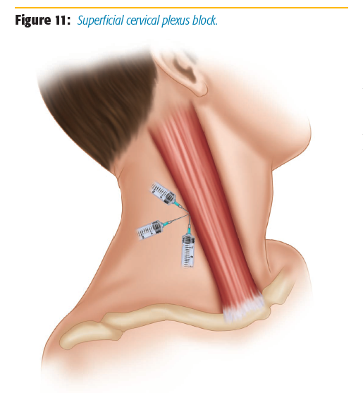 figure_11
