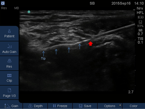 figure_2_fnb_acb