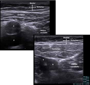 figure_3_anderson