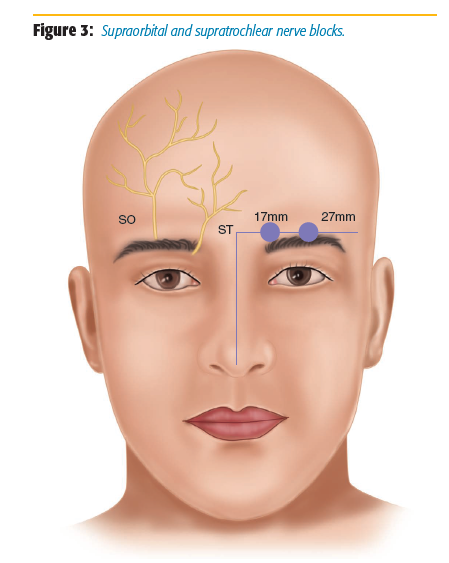 figure_3