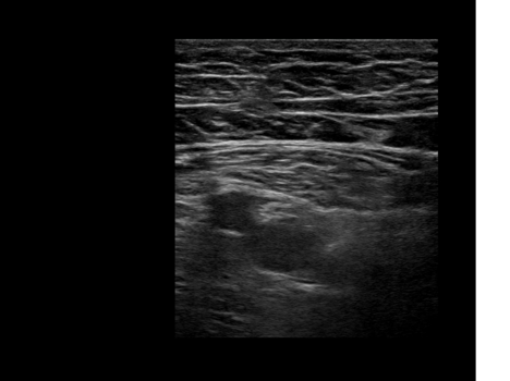 figure_5a_fnb_acb