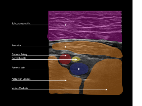 figure_5b_fnb_acb
