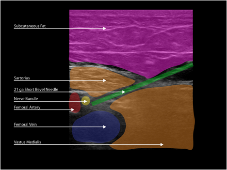 figure_7b_fnb_acb
