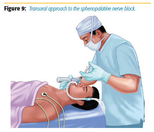 figure_9