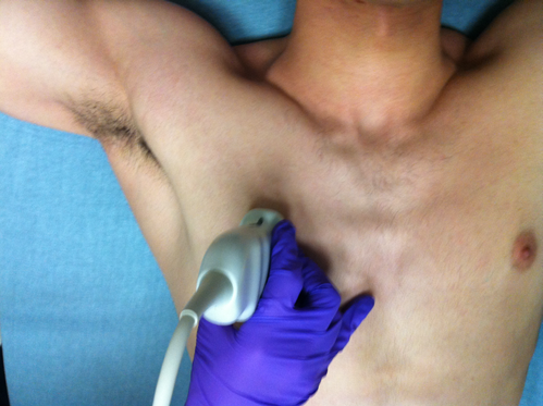 Manson_POCUS_Figure1_News022022