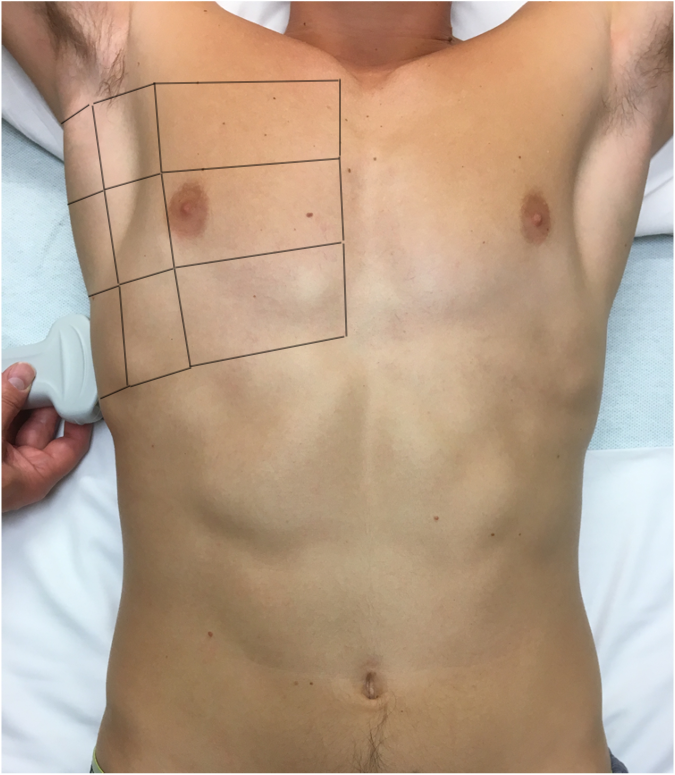 Manson_POCUS_Figure2_News022022