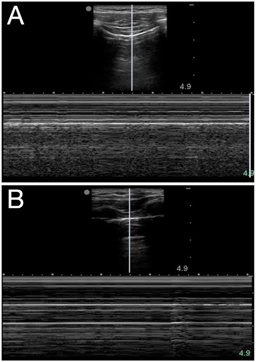 Manson_POCUS_Figure3_News022022