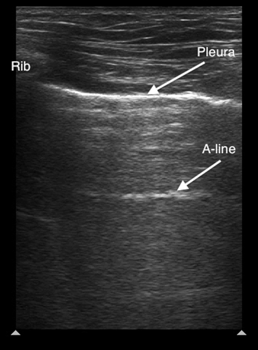 Manson_POCUS_Figure4_News022022