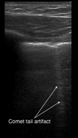 Manson_POCUS_Figure5_News022022