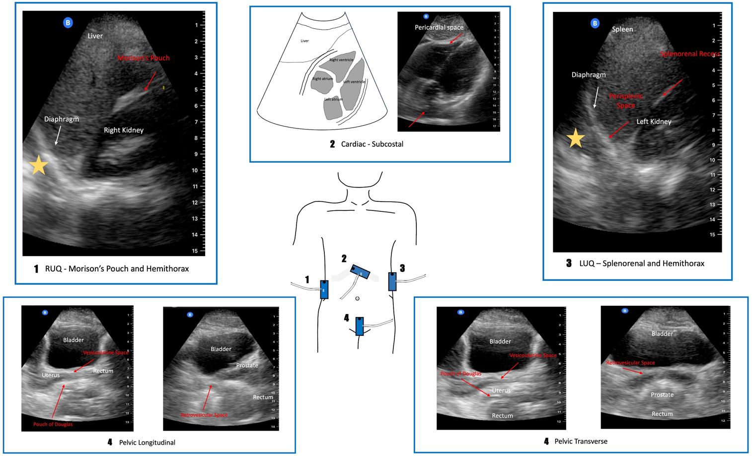 Imaging obtained for each of the FAST exam views
